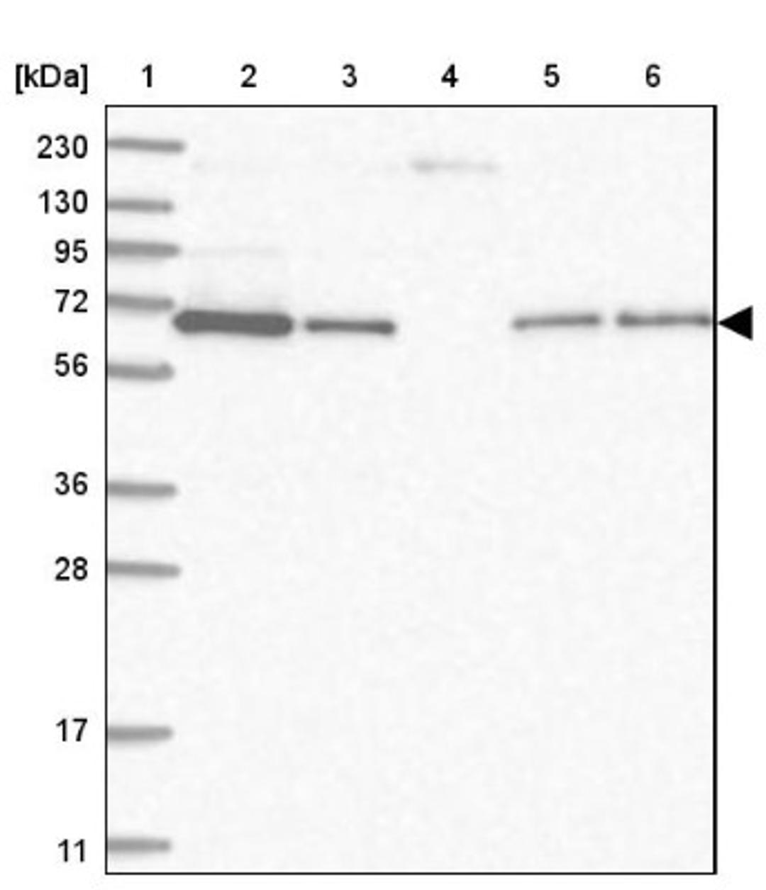 Western Blot: STAM2 Antibody [NBP1-83288] - Lane 1: Marker [kDa] 230, 130, 95, 72, 56, 36, 28, 17, 11<br/>Lane 2: Human cell line RT-4<br/>Lane 3: Human cell line U-251MG sp<br/>Lane 4: Human plasma (IgG/HSA depleted)<br/>Lane 5: Human liver tissue<br/>Lane 6: Human tonsil tissue