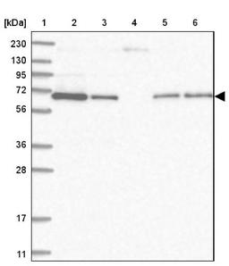 Western Blot: STAM2 Antibody [NBP1-83288] - Lane 1: Marker [kDa] 230, 130, 95, 72, 56, 36, 28, 17, 11<br/>Lane 2: Human cell line RT-4<br/>Lane 3: Human cell line U-251MG sp<br/>Lane 4: Human plasma (IgG/HSA depleted)<br/>Lane 5: Human liver tissue<br/>Lane 6: Human tonsil tissue