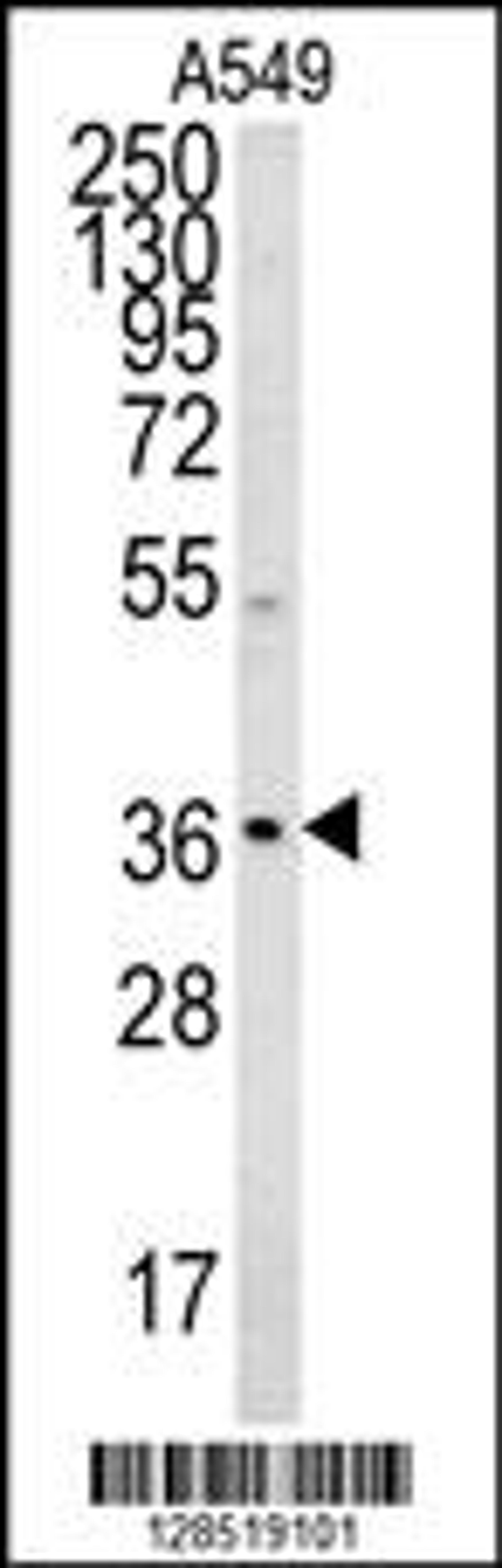 Western blot analysis in A549 cell line lysates (35ug/lane).This demonstrates the ORdetected the NGRN protein (arrow).