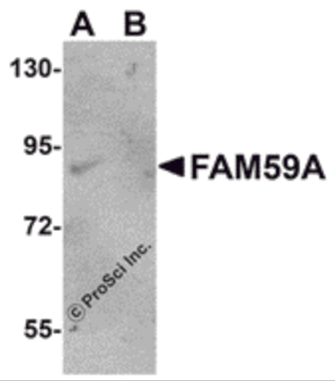 Western blot analysis of FAM59A in rat liver tissue lysate with FAM59A antibody at 1 μg/mL in (A) the absence and (B) the presence of blocking peptide.
