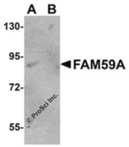 Western blot analysis of FAM59A in rat liver tissue lysate with FAM59A antibody at 1 μg/mL in (A) the absence and (B) the presence of blocking peptide.