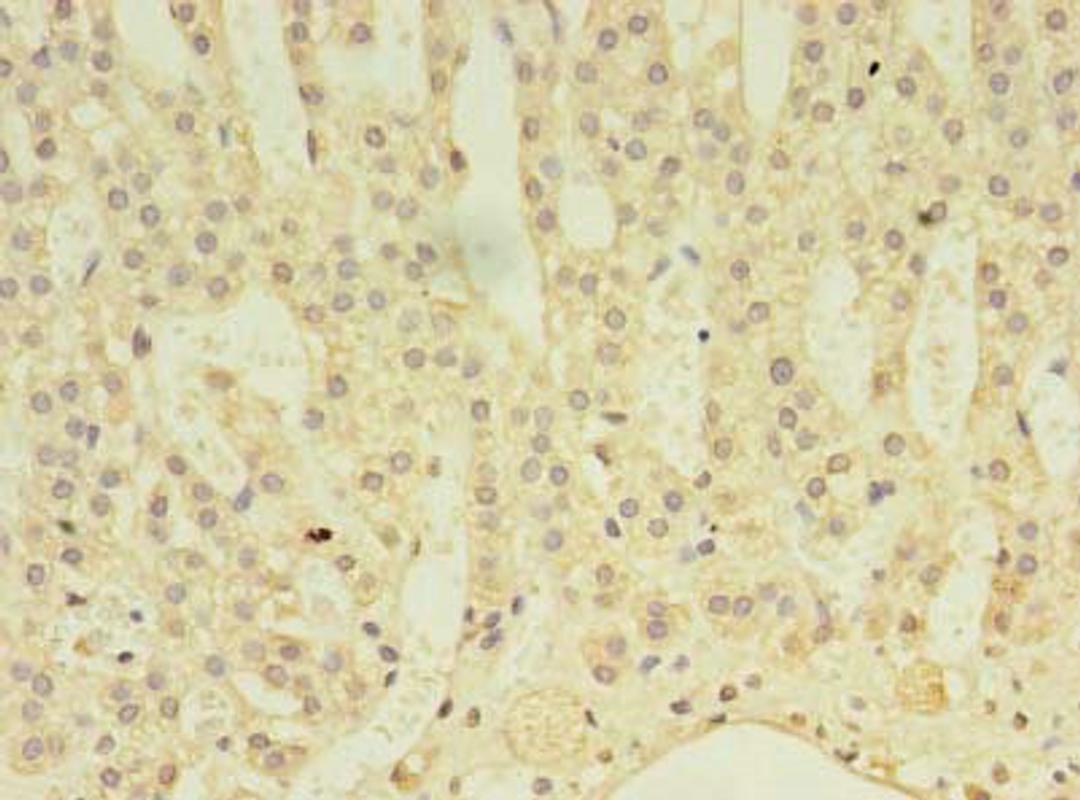 Immunohistochemistry of paraffin-embedded human adrenal gland tissue using CSB-PA001109LA01HU at dilution of 1:100