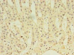 Immunohistochemistry of paraffin-embedded human adrenal gland tissue using CSB-PA001109LA01HU at dilution of 1:100