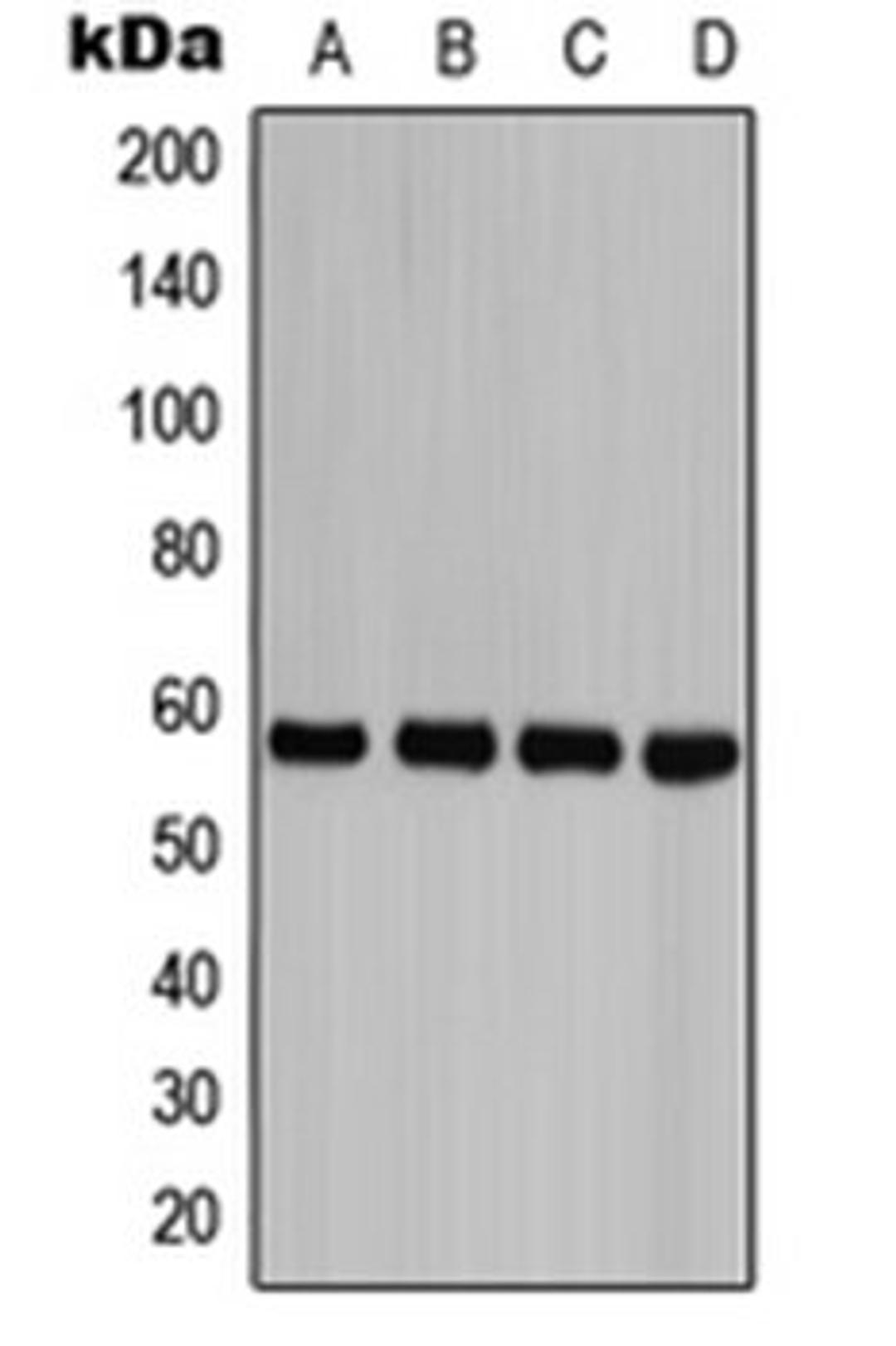 Western blot analysis of HEK293T PMA-treated (Lane 1), Jurkat etoposide-treated (Lane 2), HeLa PMA-treated (Lane 3), H9C2 PMA-treated (Lane 4) whole cell lysates using CASP8 antibody