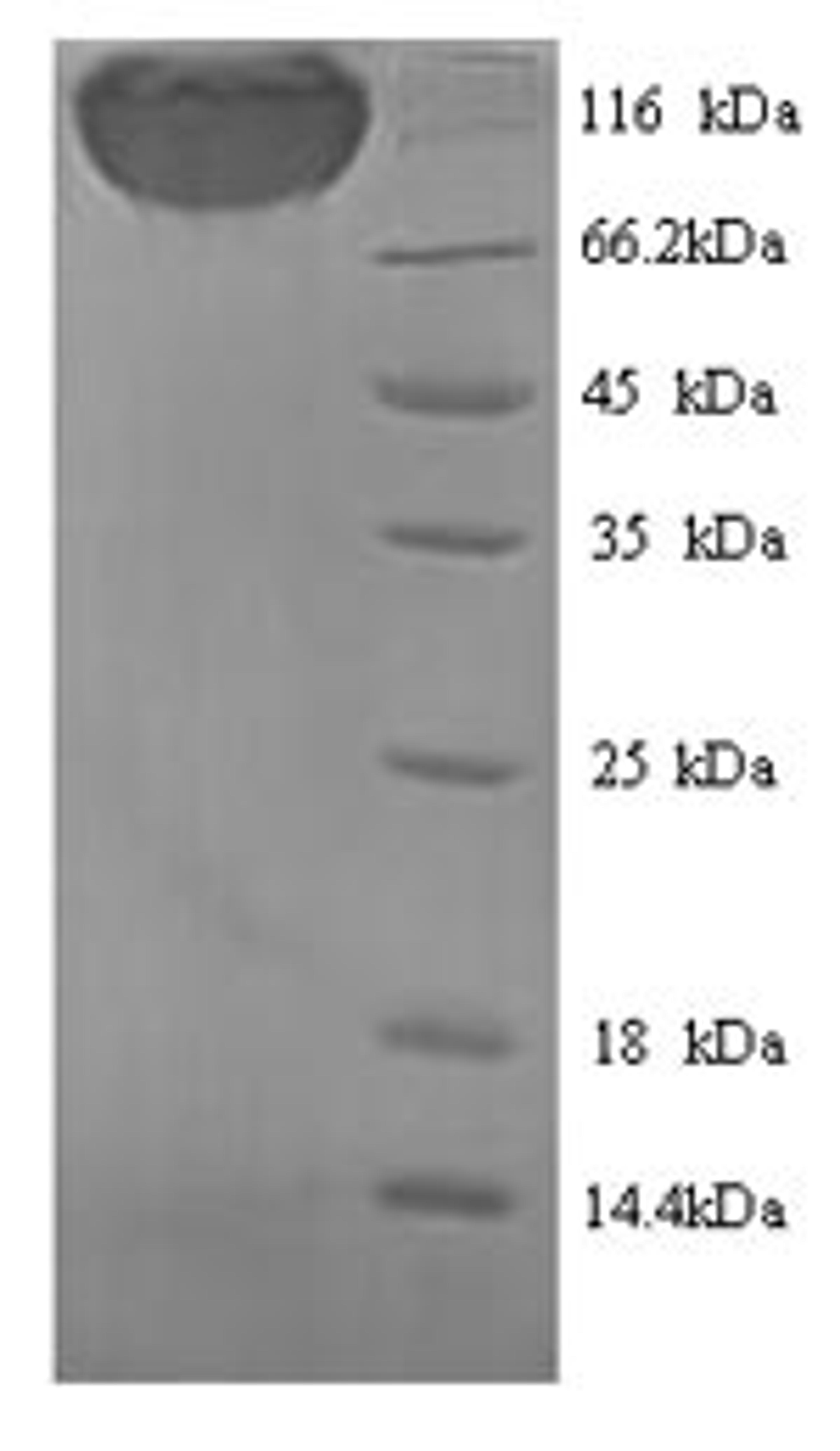 (Tris-Glycine gel) Discontinuous SDS-PAGE (reduced) with 5% enrichment gel and 15% separation gel.