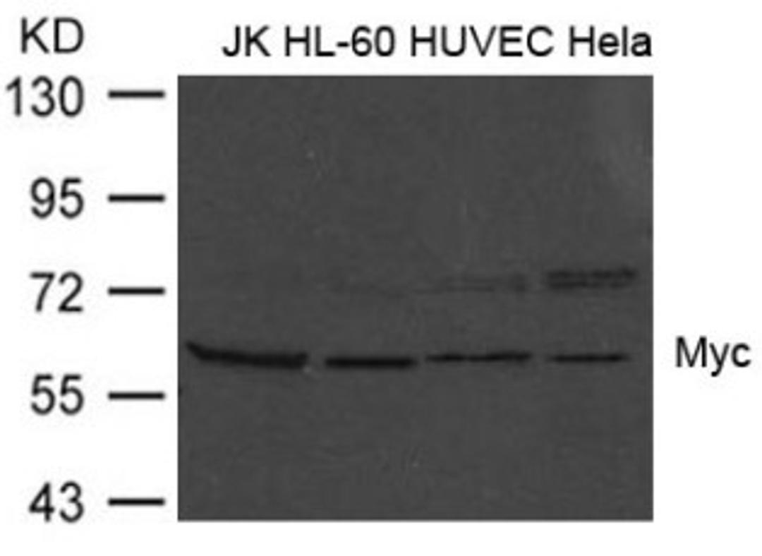 Western blot analysis of extract from JK, HL-60, HUVEC and HeLa cells using Myc (Ab-373).