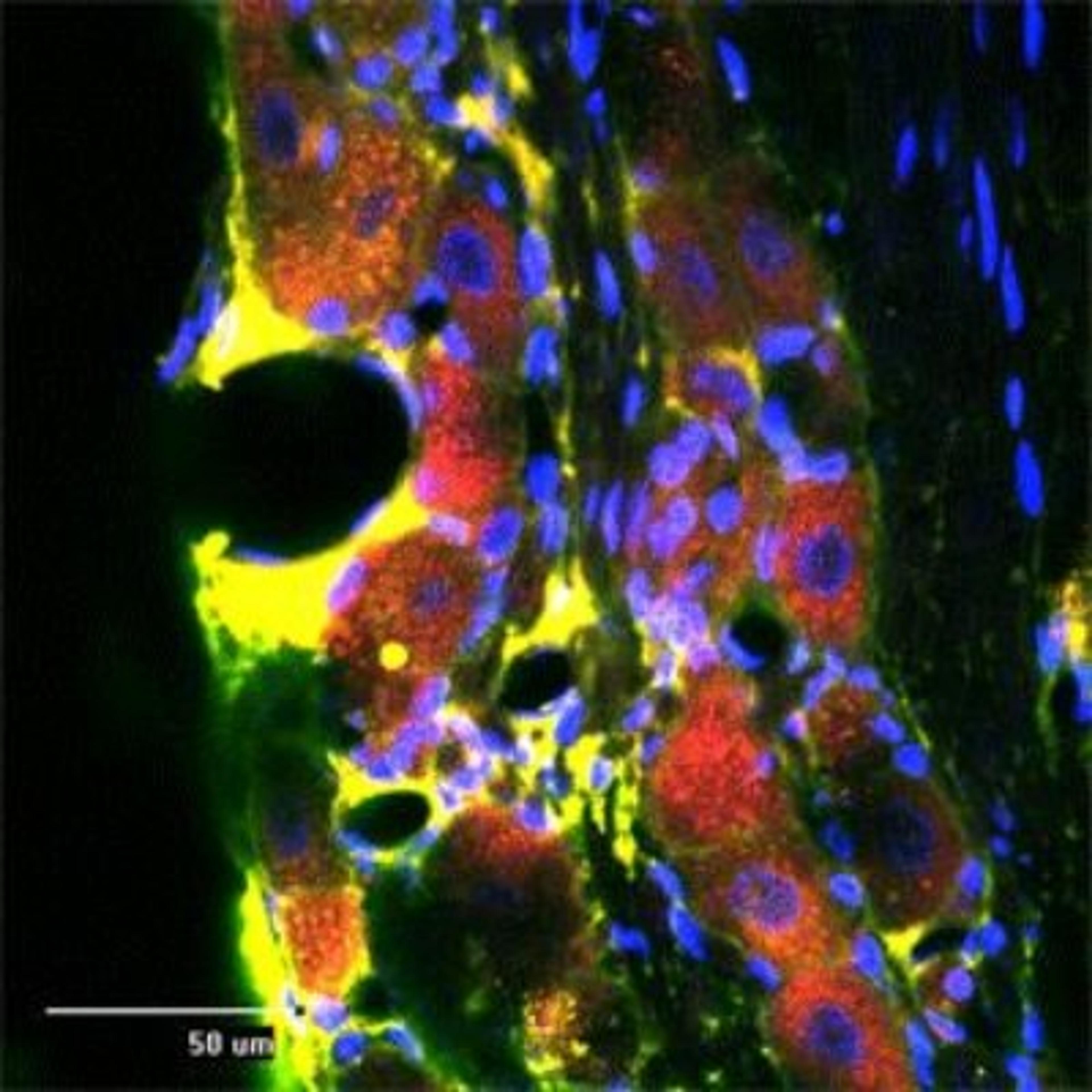 Immunocytochemistry/Immunofluorescence: RhoA Antibody [NB100-91273] - Rat trigeminal at 1:500 dilution using Rabbit antibody to Transforming protein RhoA: whole serum (NB100-91273, in red), Sheep antibody to extracellular, N-terminal part of Sortilin: whole serum (NB100-98771, in green), DAPI counter stained appearing in blue.