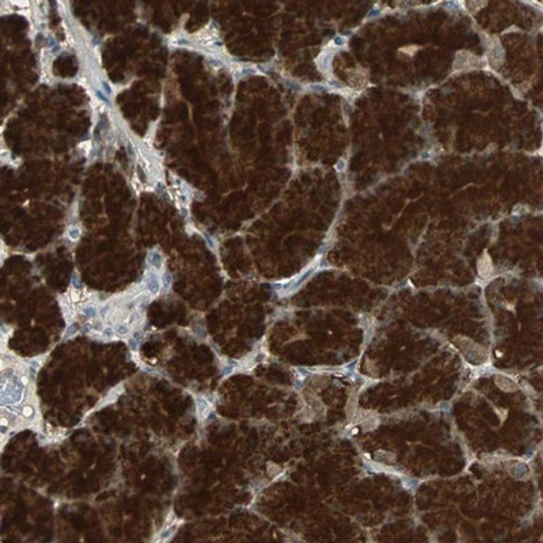 Immunohistochemistry-Paraffin: ABHD2 Antibody [NBP1-82850] - Staining of human stomach shows strong cytoplasmic positivity in glandular cells.