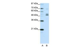 Antibody used in WB on Human HepG2 cells at 0.625 ug/ml.