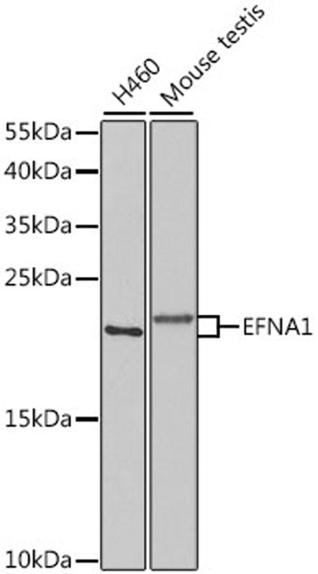 Western blot - EFNA1 antibody (A5341)