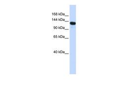 Antibody used in WB on Transfected 293T at 0.2-1 ug/ml.