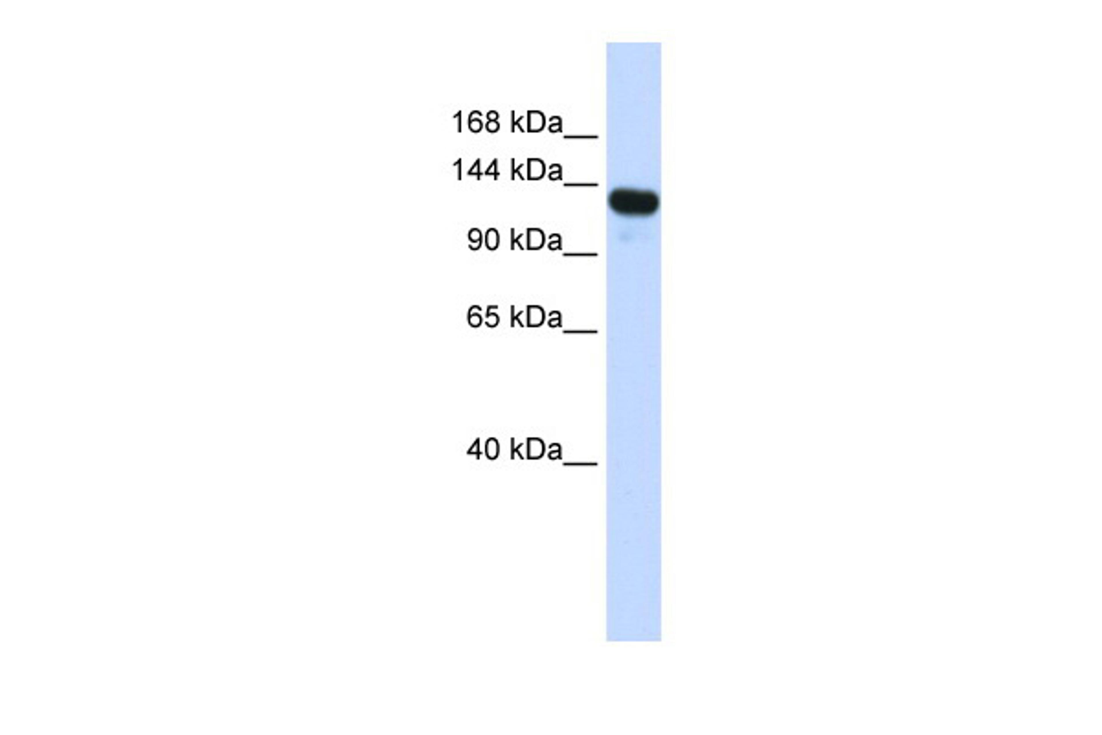 Antibody used in WB on Transfected 293T at 0.2-1 ug/ml.