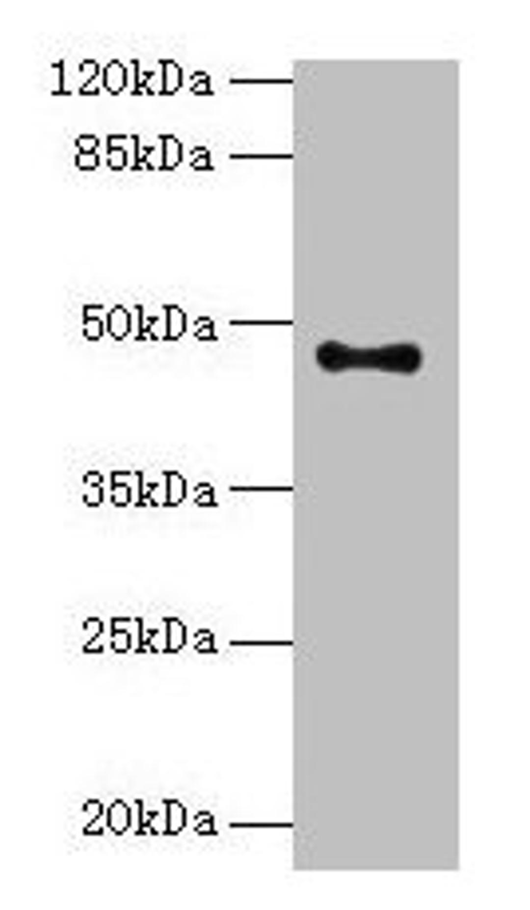 Western blot. All lanes: AADACL2 antibody at 1:500 + PC-3 whole cell lysate. Secondary. Goat polyclonal to rabbit IgG at 1/10000 dilution. Predicted band size: 47, 6 kDa. Observed band size: 47 kDa
