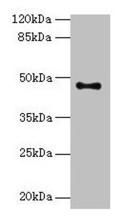 Western blot. All lanes: AADACL2 antibody at 1:500 + PC-3 whole cell lysate. Secondary. Goat polyclonal to rabbit IgG at 1/10000 dilution. Predicted band size: 47, 6 kDa. Observed band size: 47 kDa