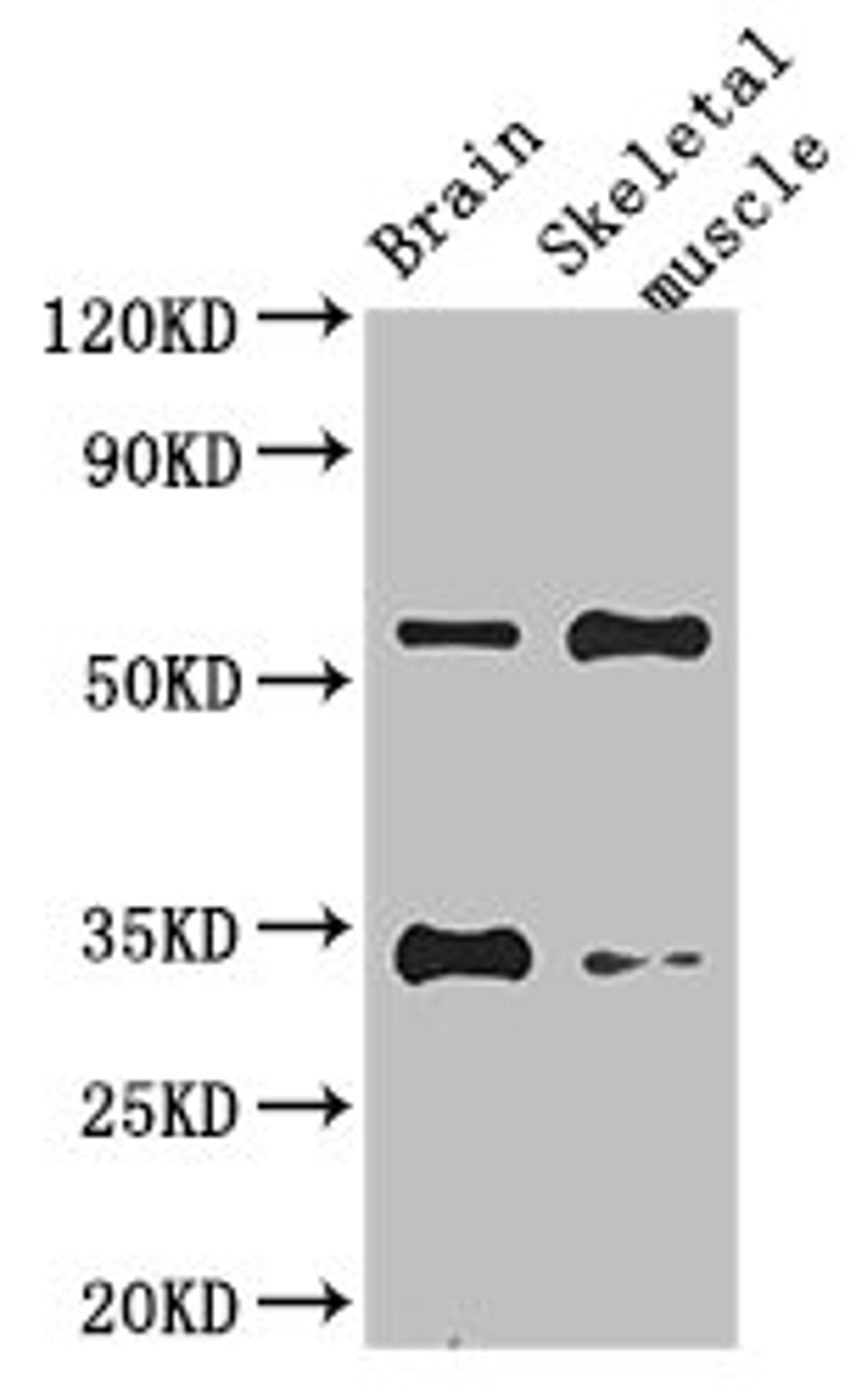 Western Blot. Positive WB detected in: Mouse brain tissue, Mouse skeletal muscle tissue. All lanes: VTN antibody at 1:700. Secondary. Goat polyclonal to rabbit IgG at 1/50000 dilution. Predicted band size: 55 kDa. Observed band size: 55, 34 kDa
