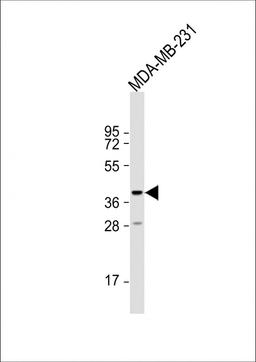 Western Blot at 1:1000 dilution + MDA-MB-231 whole cell lysate Lysates/proteins at 20 ug per lane.