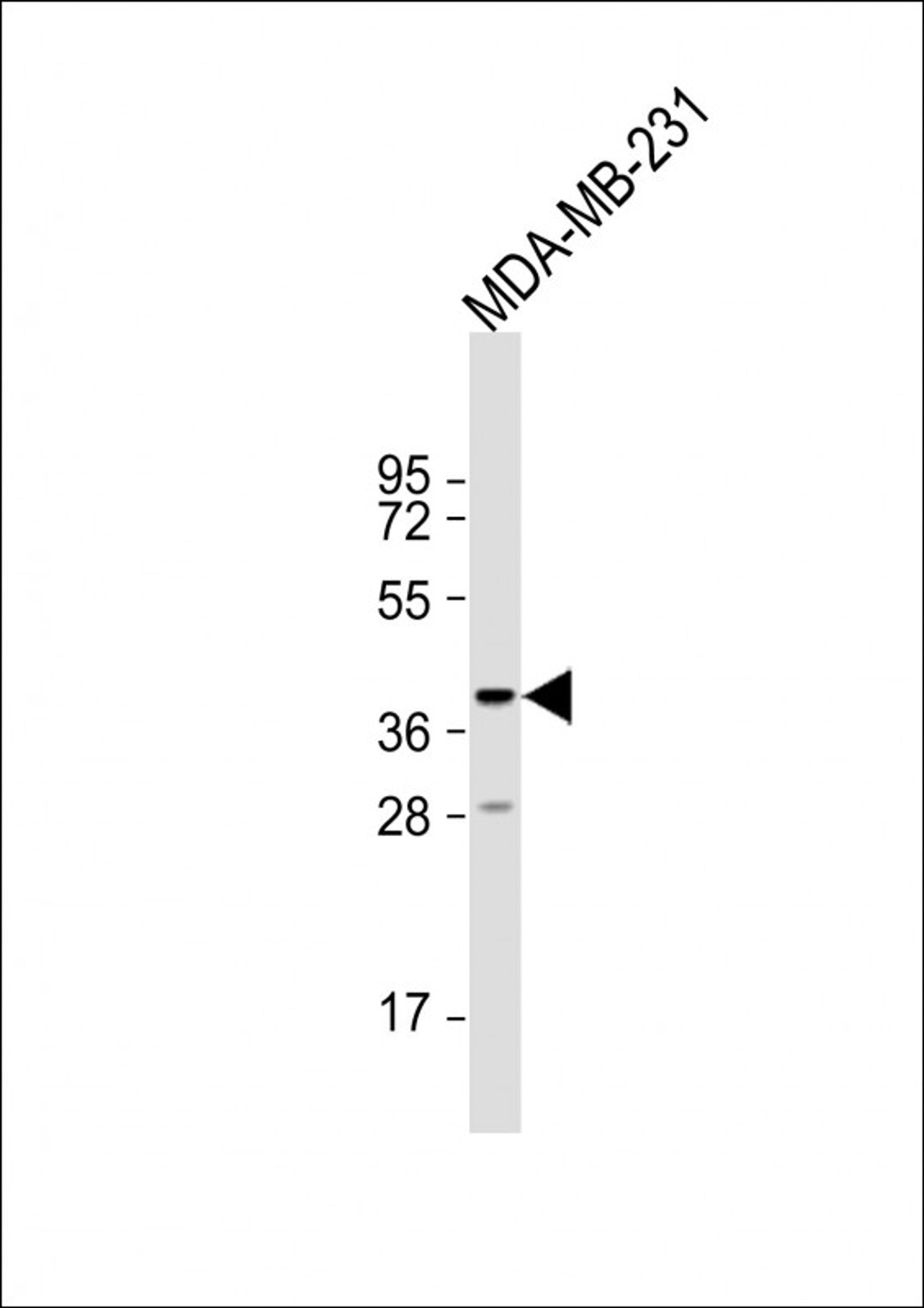 Western Blot at 1:1000 dilution + MDA-MB-231 whole cell lysate Lysates/proteins at 20 ug per lane.