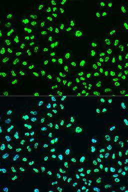 Immunofluorescence - Phospho-BRCA1-S988 antibody (AP0318)