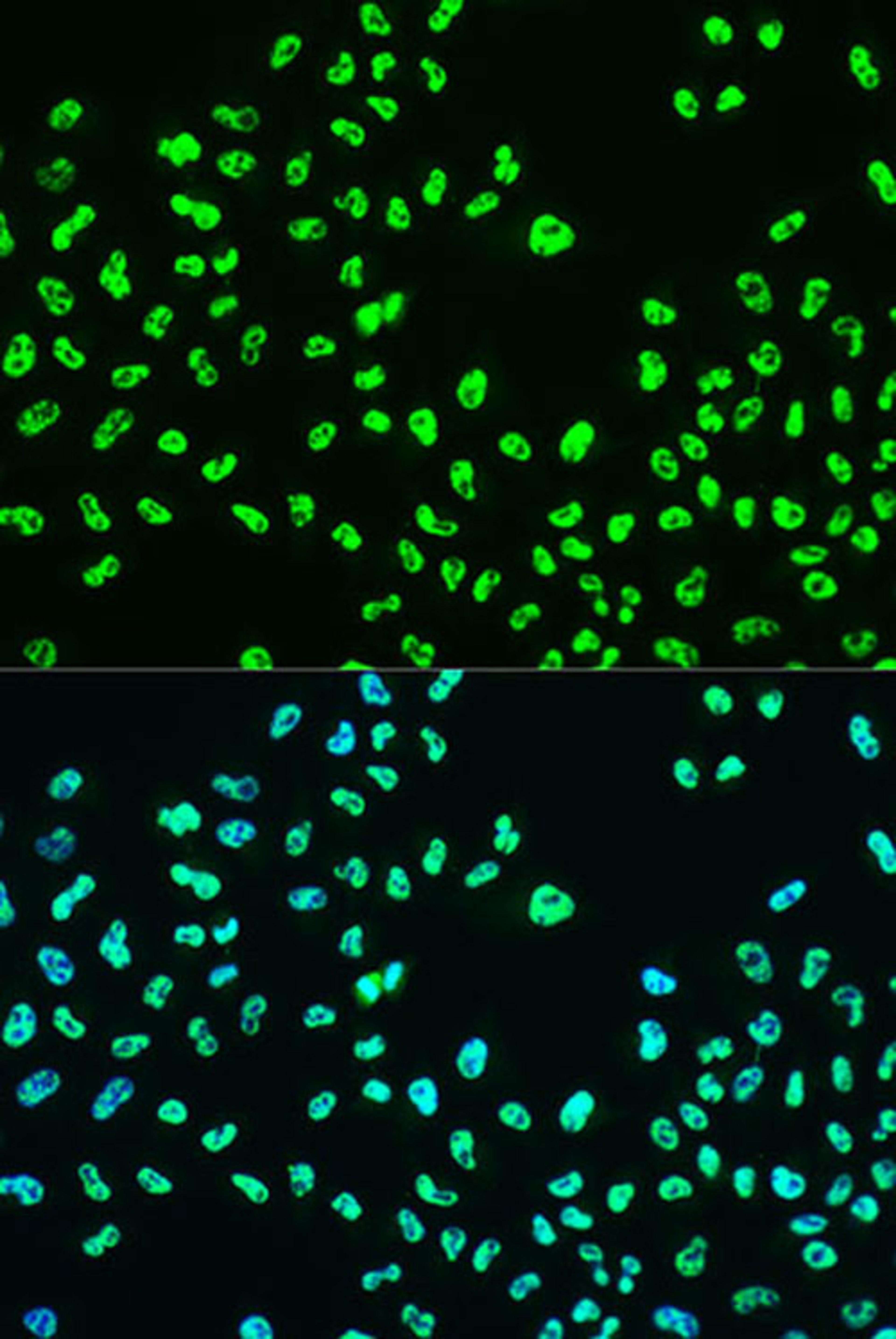 Immunofluorescence - Phospho-BRCA1-S988 antibody (AP0318)