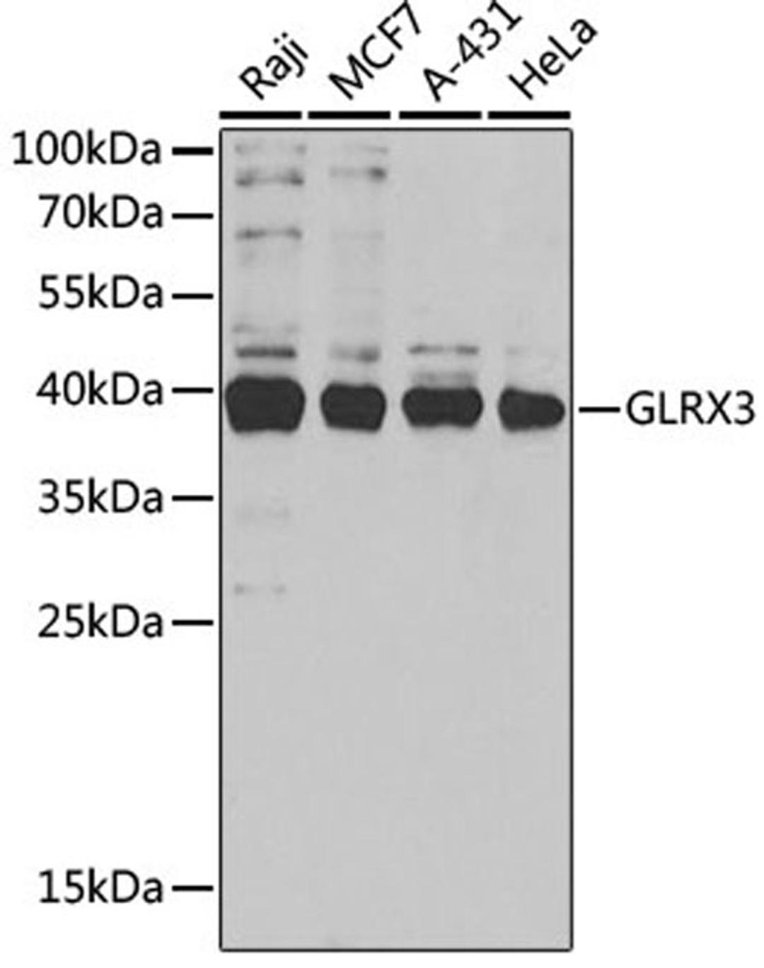 Western blot - GLRX3 antibody (A5892)