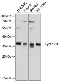 Western blot - Cyclin D1 antibody (A11310)