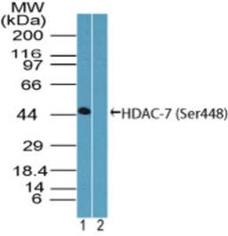 Western Blot: HDAC7 [p Ser448] Antibody [NBP2-03979] - Analysis of phosphorylated HDAC-7 in (A) recombinant fusion protein containing Ser448 and (B) fusion protein without the phosphorylated amino acid, using this antibody at 1 ug/ml.