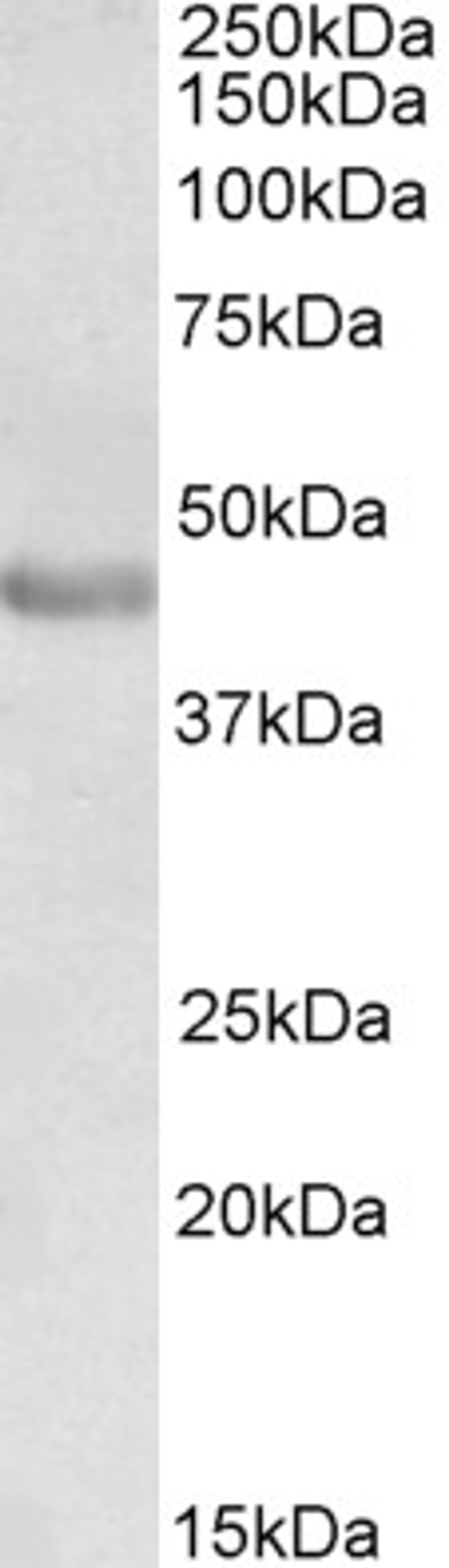 46-138 (0.3ug/ml) staining of Human Duodenum lysate (35ug protein in RIPA buffer). Detected by chemiluminescence.