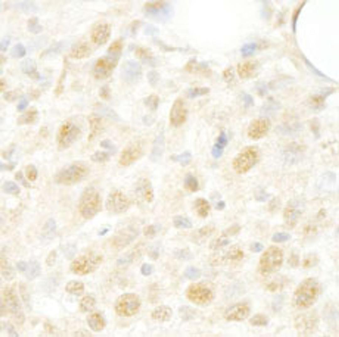 Detection of mouse CROP/Luc7A by immunohistochemistry.