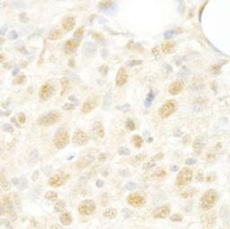 Detection of mouse CROP/Luc7A by immunohistochemistry.