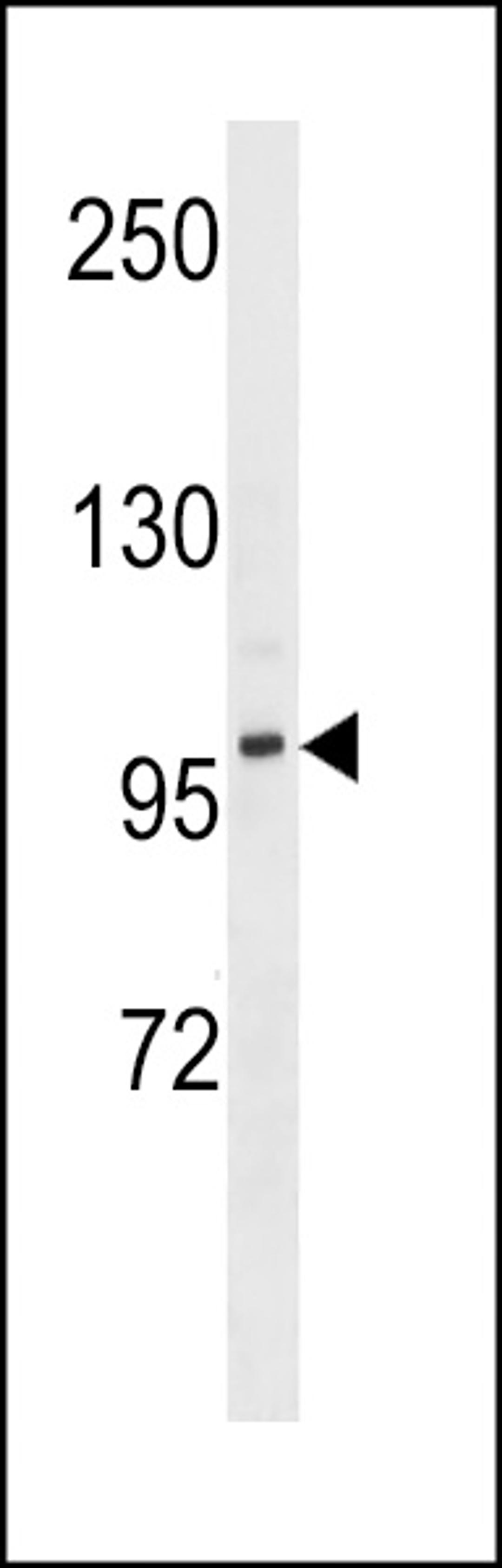 Western blot analysis in MDA-MB453 cell line lysates (35ug/lane).