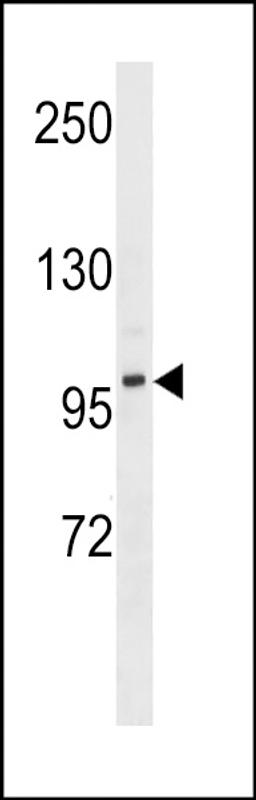 Western blot analysis in MDA-MB453 cell line lysates (35ug/lane).