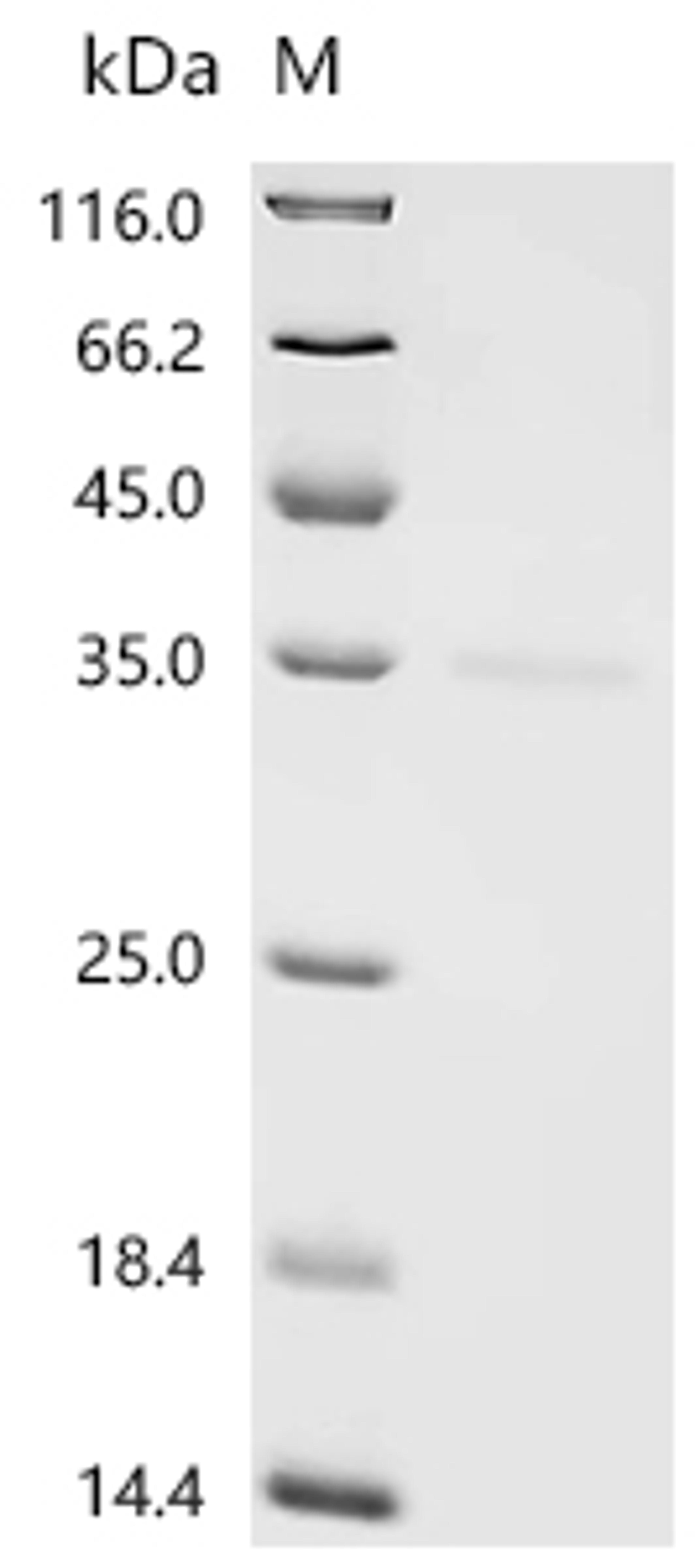 (Tris-Glycine gel) Discontinuous SDS-PAGE (reduced) with 5% enrichment gel and 15% separation gel.