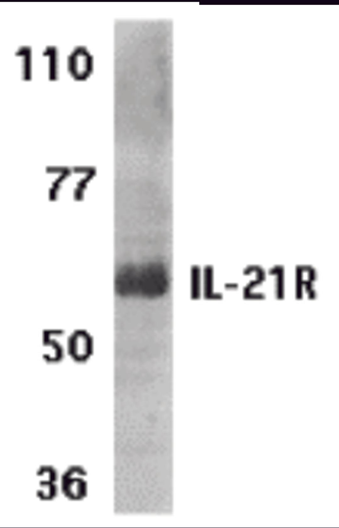 Western blot analysis of IL-21 receptor expression in human Raji cell lysate with IL-21 receptor antibody at 1 μg /ml.