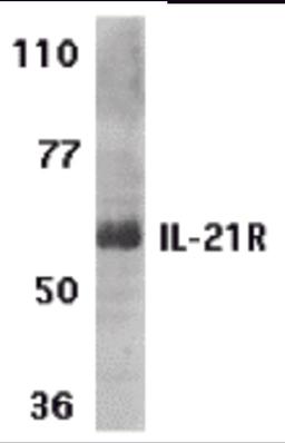 Western blot analysis of IL-21 receptor expression in human Raji cell lysate with IL-21 receptor antibody at 1 μg /ml.