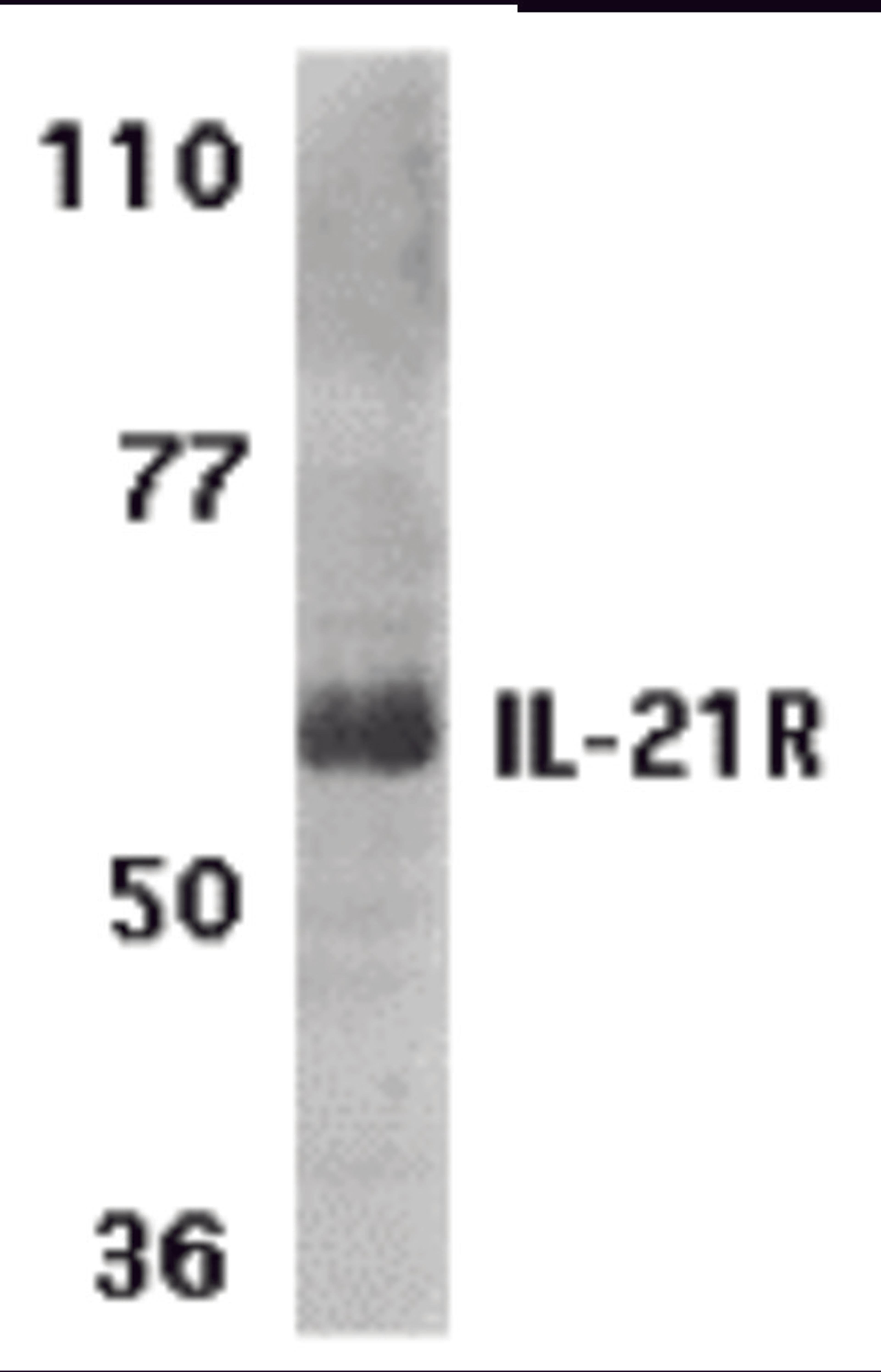 Western blot analysis of IL-21 receptor expression in human Raji cell lysate with IL-21 receptor antibody at 1 μg /ml.