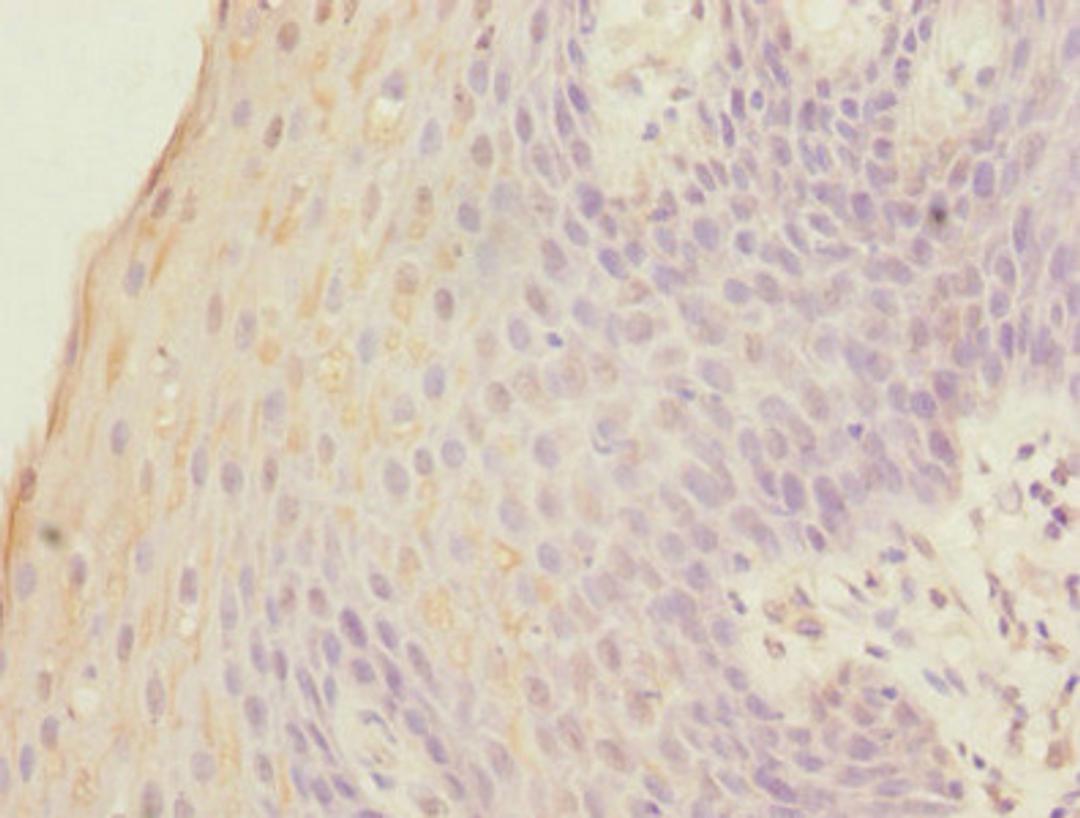 Immunohistochemistry of paraffin-embedded human tonsil tissue using CSB-PA008841EA01HU at dilution of 1:100