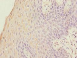 Immunohistochemistry of paraffin-embedded human tonsil tissue using CSB-PA008841EA01HU at dilution of 1:100