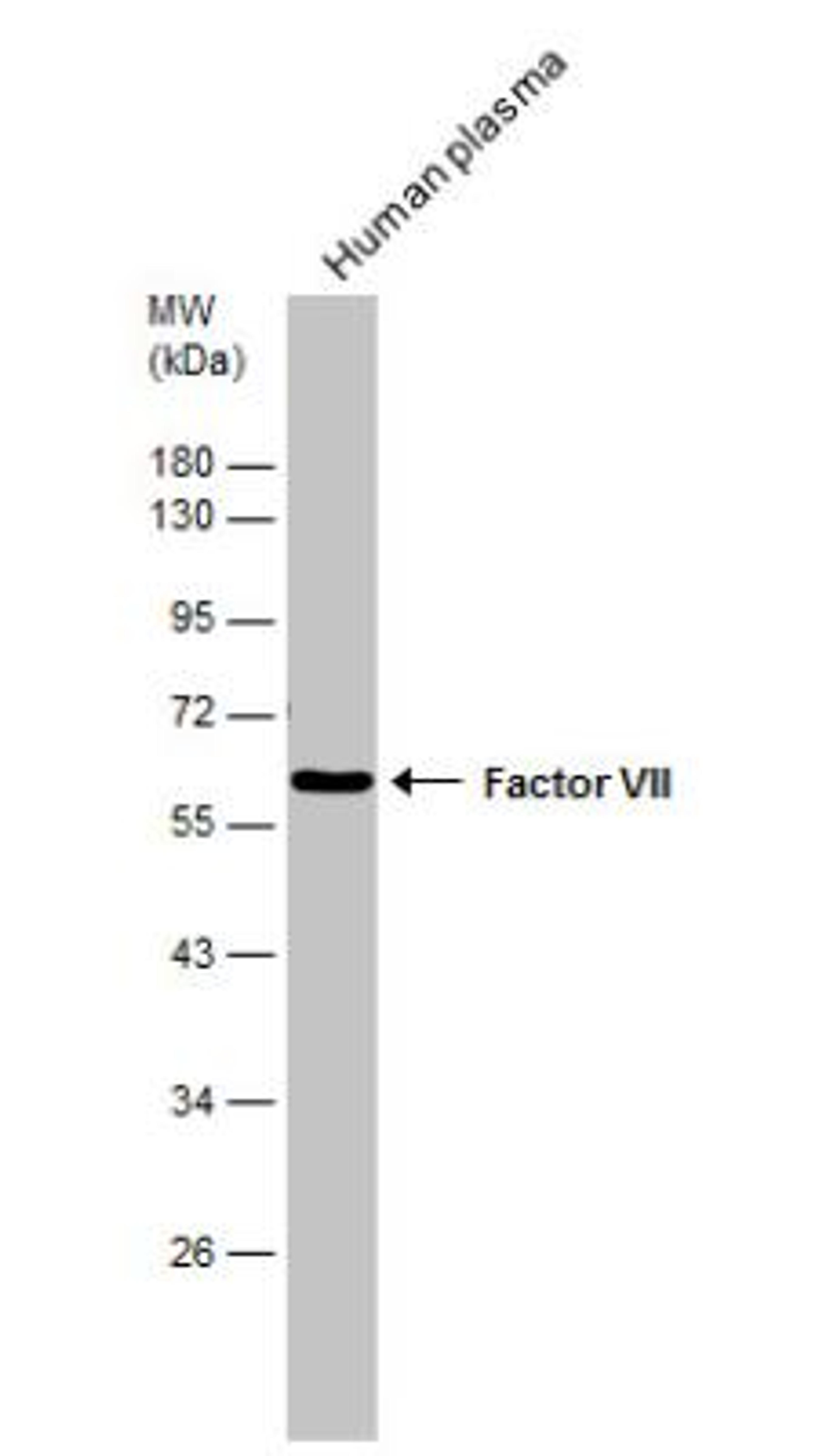 Western Blot: Coagulation Factor VII Antibody [NBP1-31421] - Human tissue extract (30 ug) was separated by 10% SDS-PAGE, and the membrane was blotted with Factor VII antibody [N3C3] diluted at 1:500.