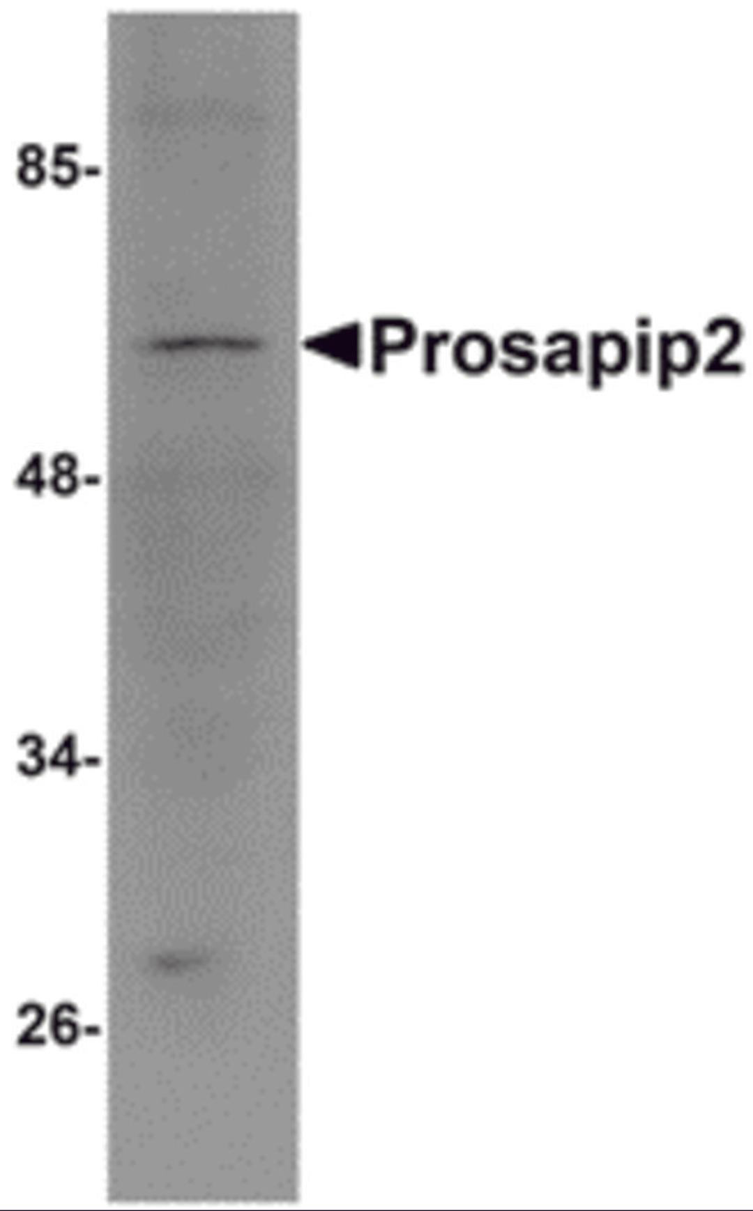 Western blot analysis of Prosapip2 in rat liver tissue lysate with Prosapip2 antibody at 1 μg/mL.