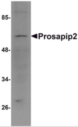Western blot analysis of Prosapip2 in rat liver tissue lysate with Prosapip2 antibody at 1 μg/mL.
