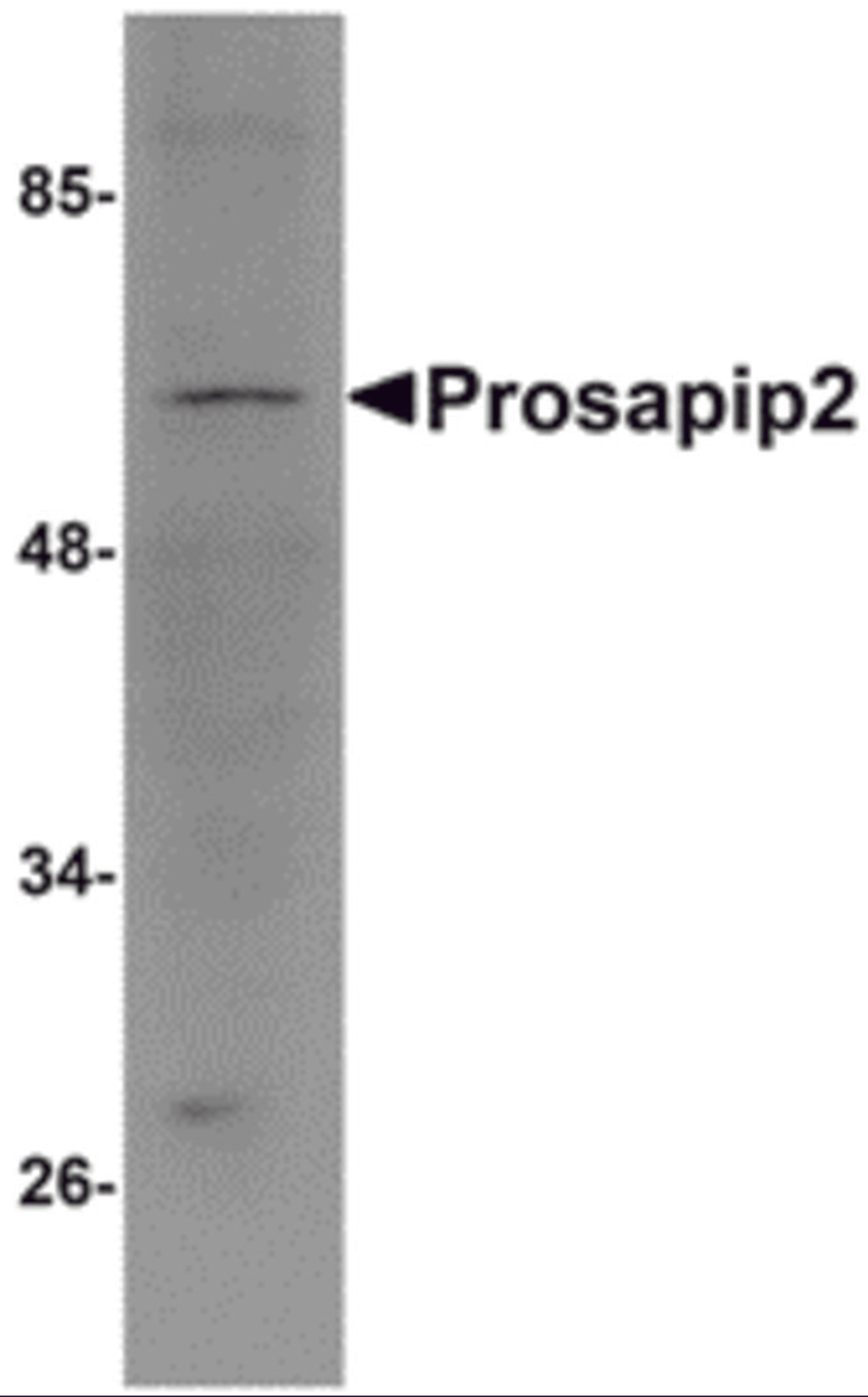 Western blot analysis of Prosapip2 in rat liver tissue lysate with Prosapip2 antibody at 1 μg/mL.