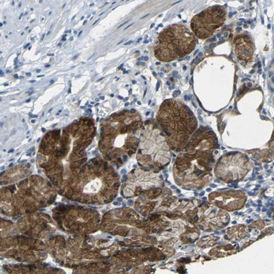 Immunohistochemistry-Paraffin: ANKRD22 Antibody [NBP1-81167] - Immunohistochemical staining of human stomach shows strong cytoplasmic and membranous positivity in glandular cells.