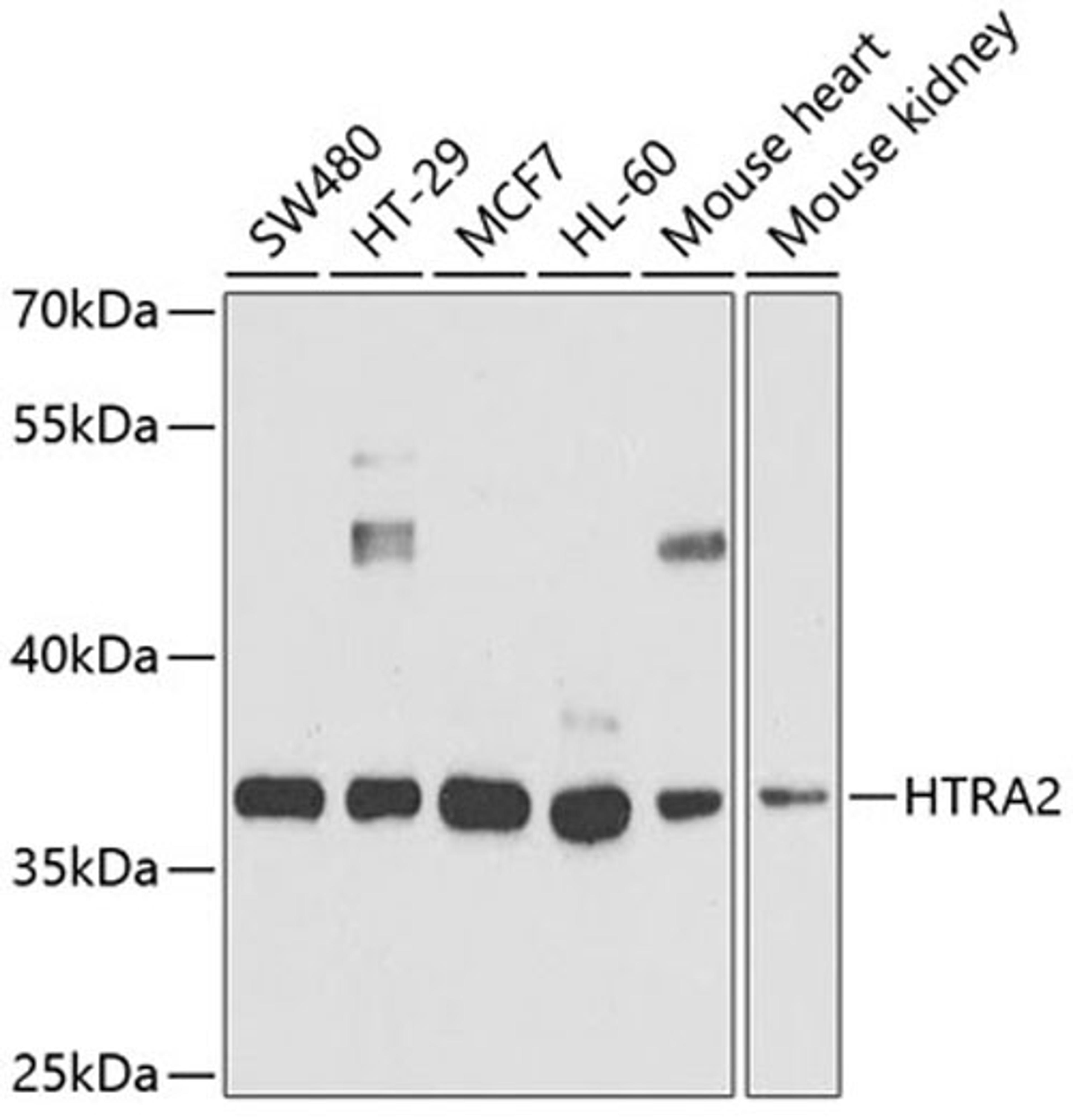 Western blot - HTRA2 antibody (A5762)