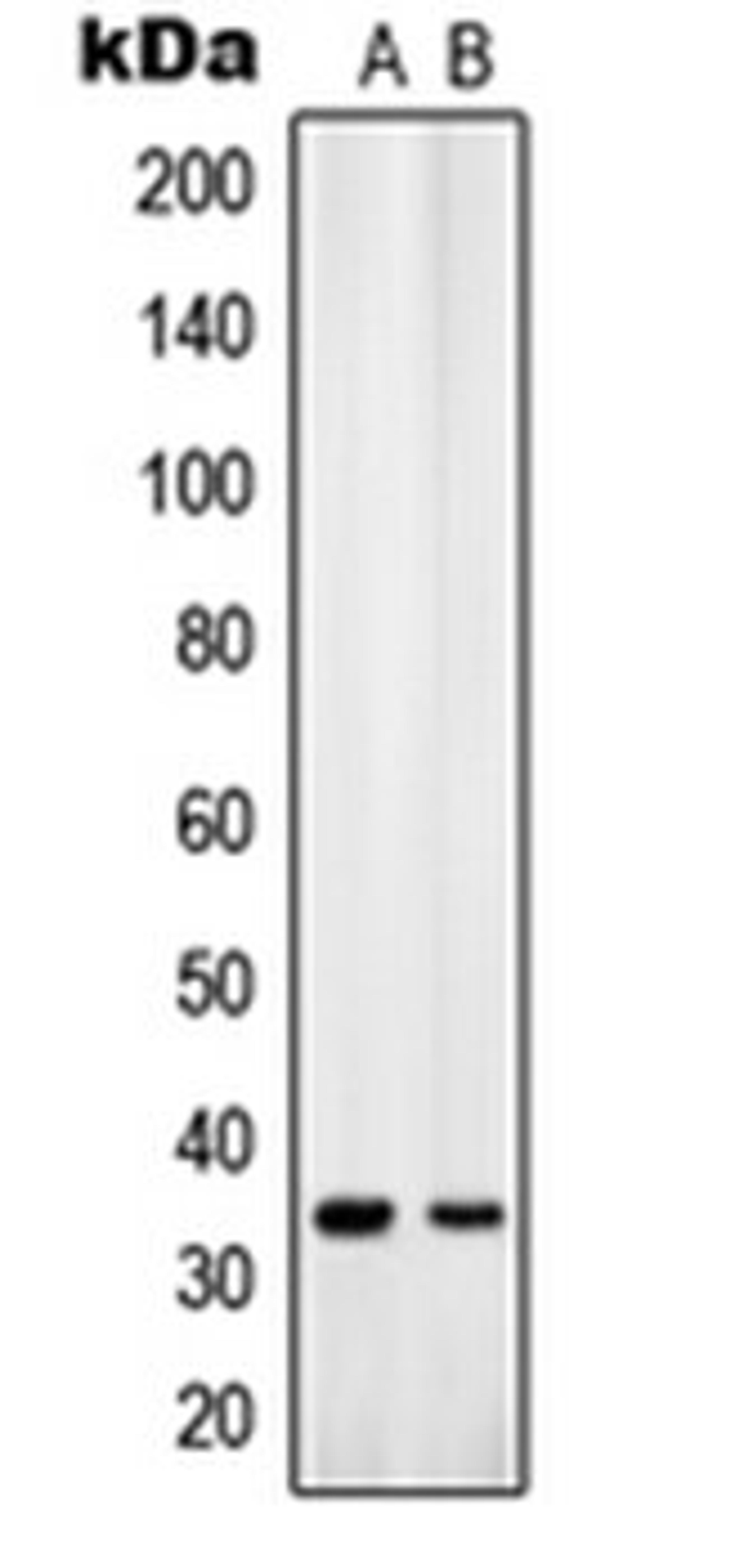 Western blot analysis of K562 (Lane 1), U251MG (Lane 2) whole cell lysates using SLC25A31 antibody