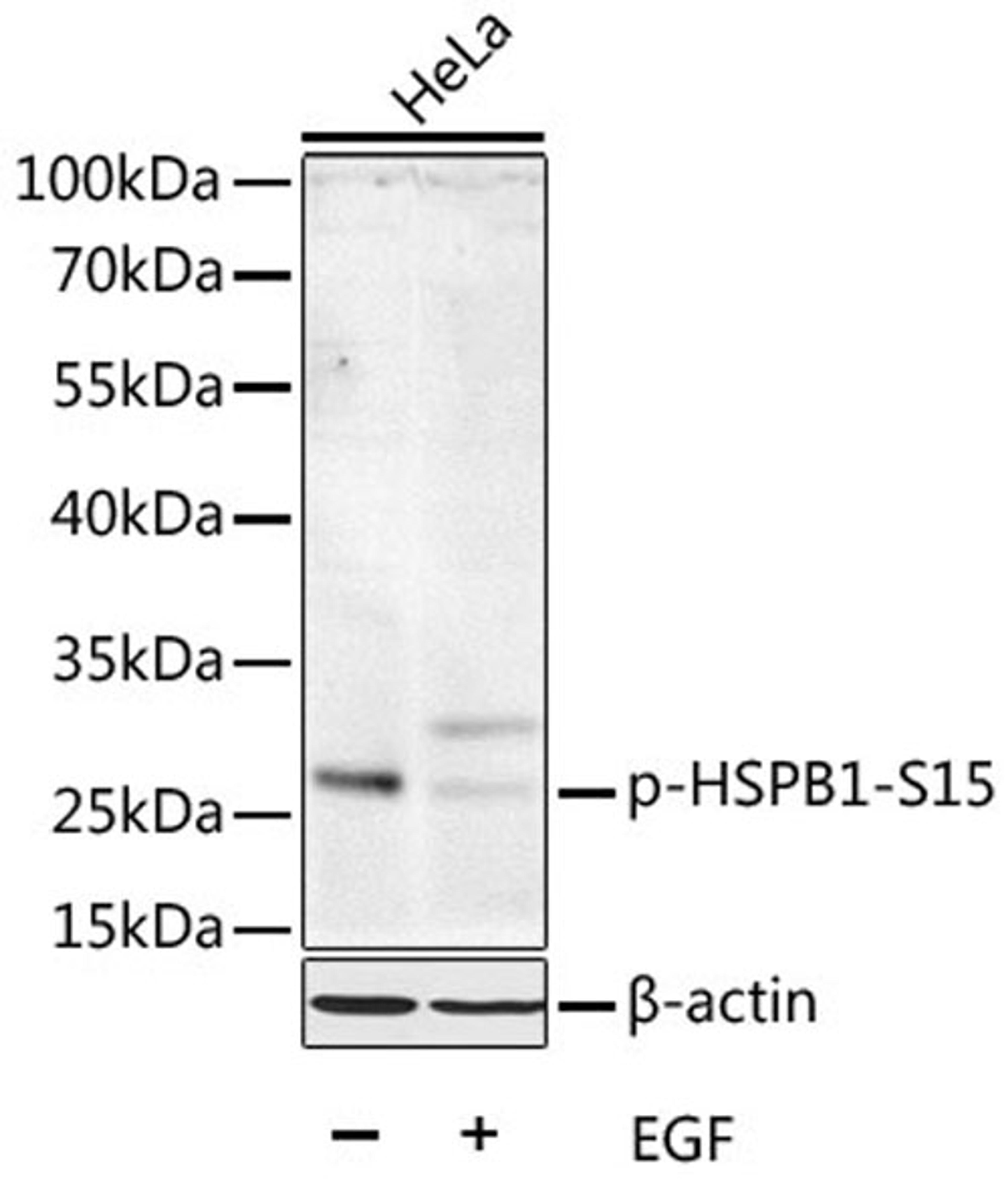 Western blot - Phospho-HSPB1-S15 antibody (AP0040)