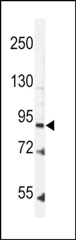 Western blot analysis in K562 cell line lysates (35ug/lane).This demonstrates the LEPR antibody detected the LEPR protein (arrow).