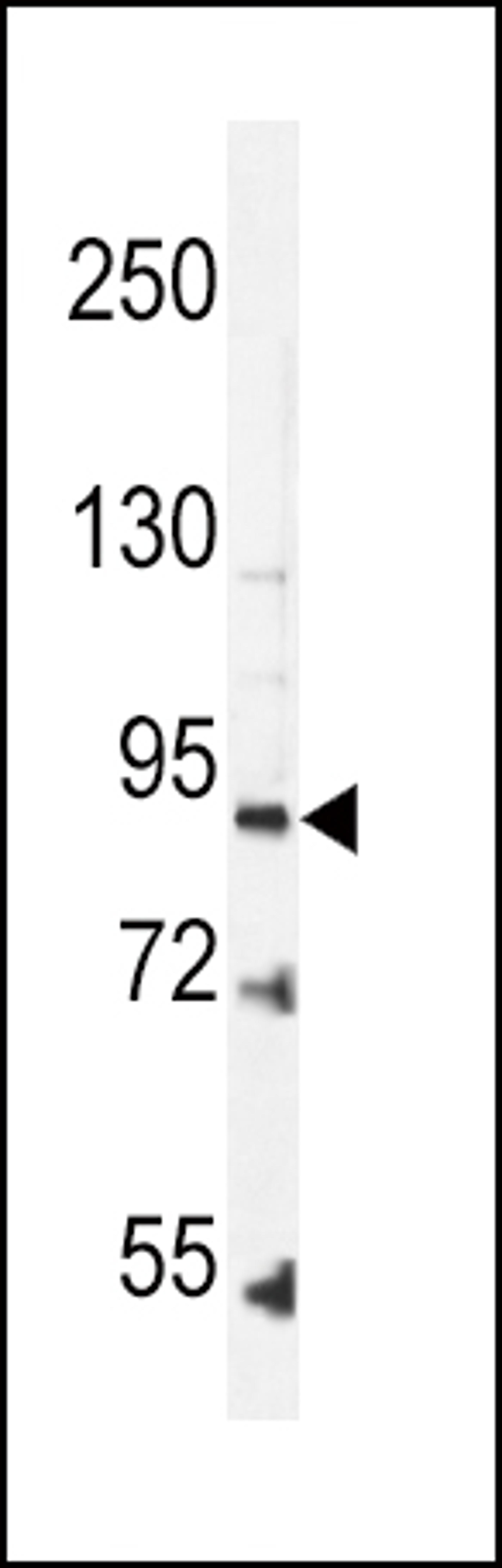 Western blot analysis in K562 cell line lysates (35ug/lane).This demonstrates the LEPR antibody detected the LEPR protein (arrow).