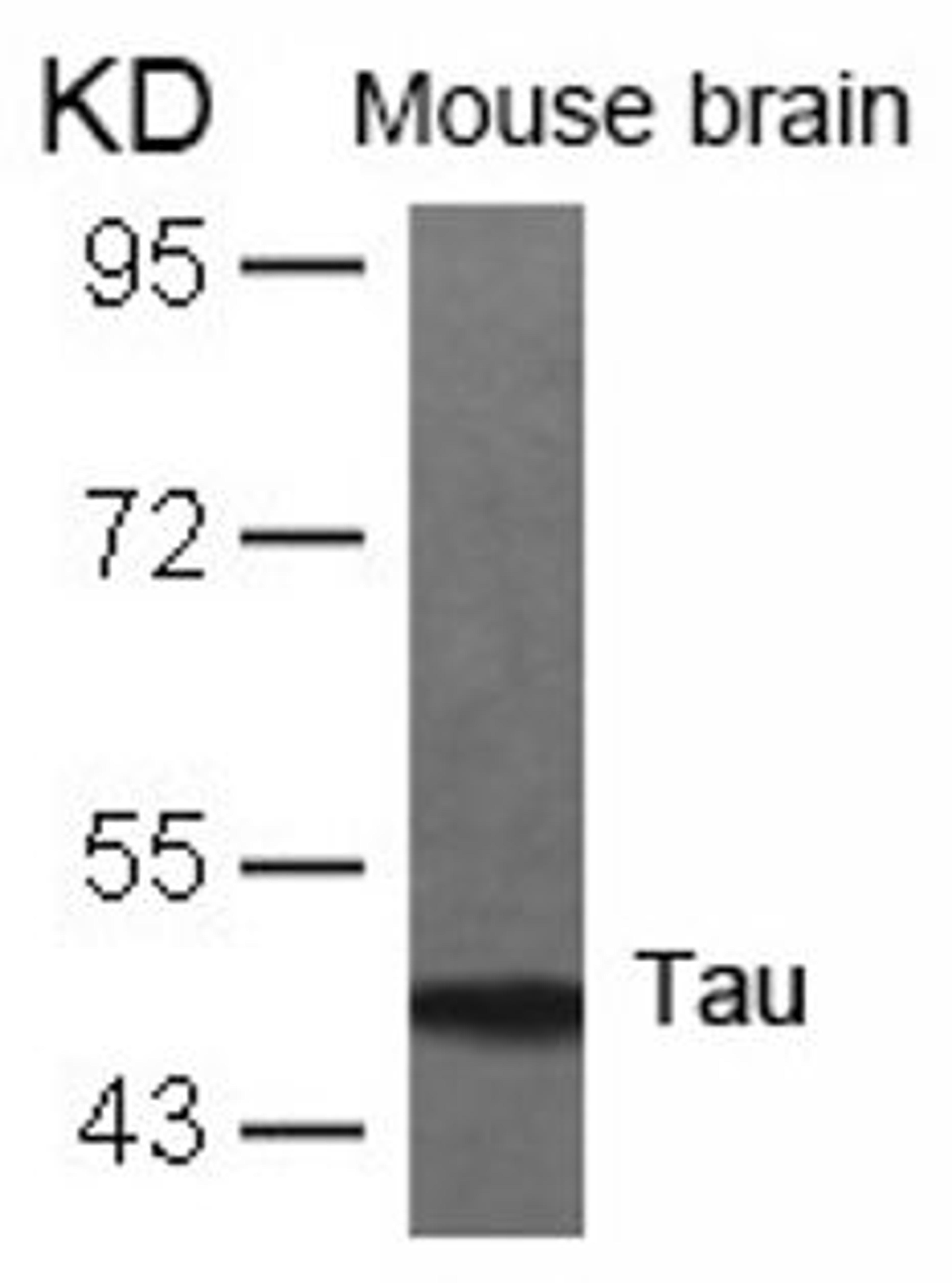 Western blot analysis of lysed extracts from mouse brain tissue using Tau (Ab-231).