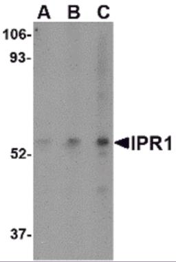 Western blot analysis of IPR1 in Hela cell lysate with IPR1 antibody at (A) 0.5, (B) 1, and (C) 2 &#956;g/mL.