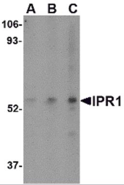 Western blot analysis of IPR1 in Hela cell lysate with IPR1 antibody at (A) 0.5, (B) 1, and (C) 2 μg/mL.